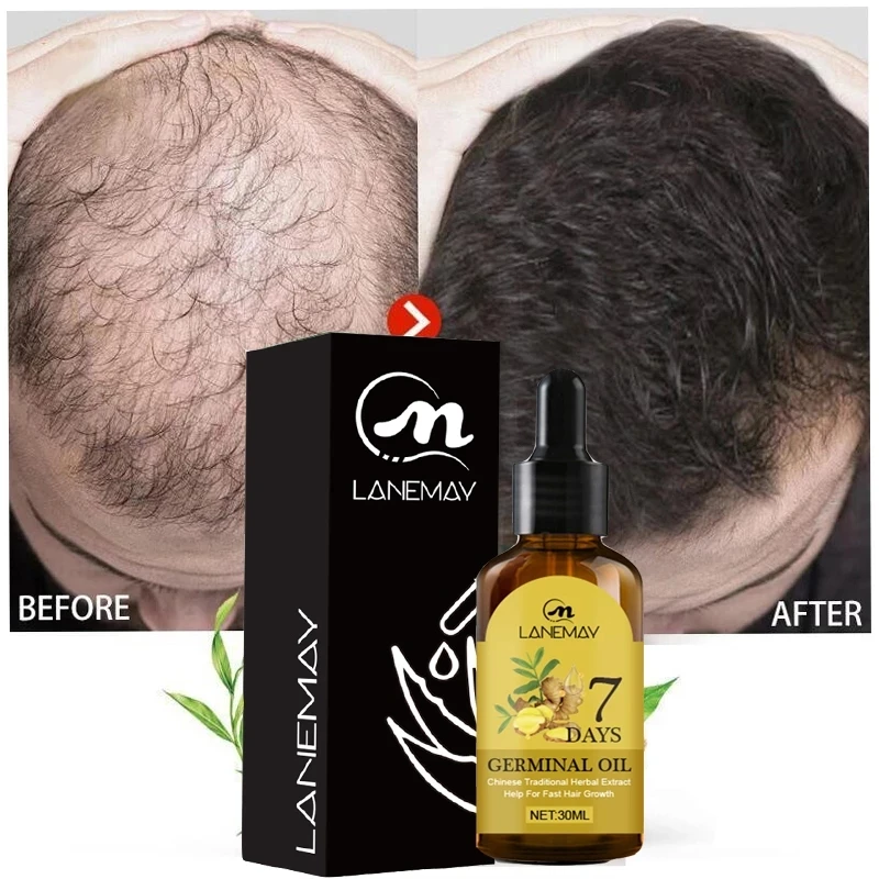 Hair Growth Essential Oils Essence Prevent Hair Loss Health Hair Care Repair Baldness Anti-dropping Promote Hair Grow Serum