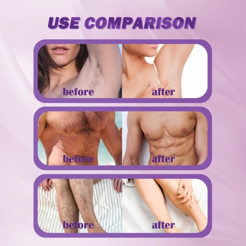 脱毛クリーム 痛みのない親密な部分 脚 ボディ 脇の下 脱毛クリーム