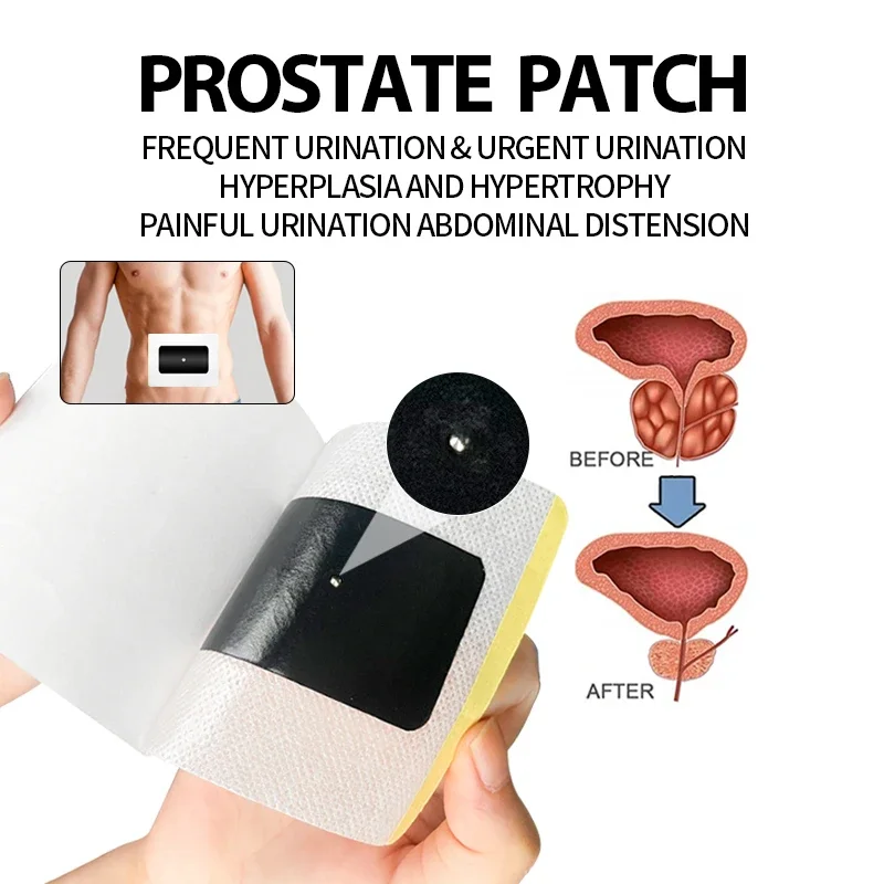 Prostate Treatment Patch Prostatitis Medicine Strengthen Kidney Frequent Urination Urgency Urethritis Prostatic Navel Plaster