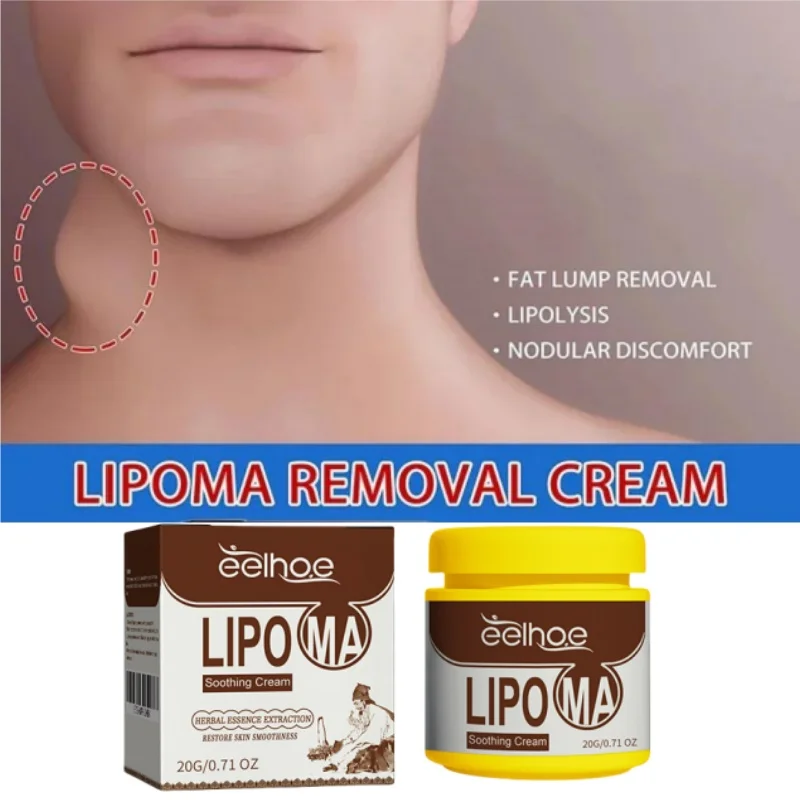 Crema calmante para eliminar bultos subcutáneos, tratamiento líquido medicinal, aplicar a la hinchazón de la piel, celulitis, Fibroma, masa de grasa, yeso