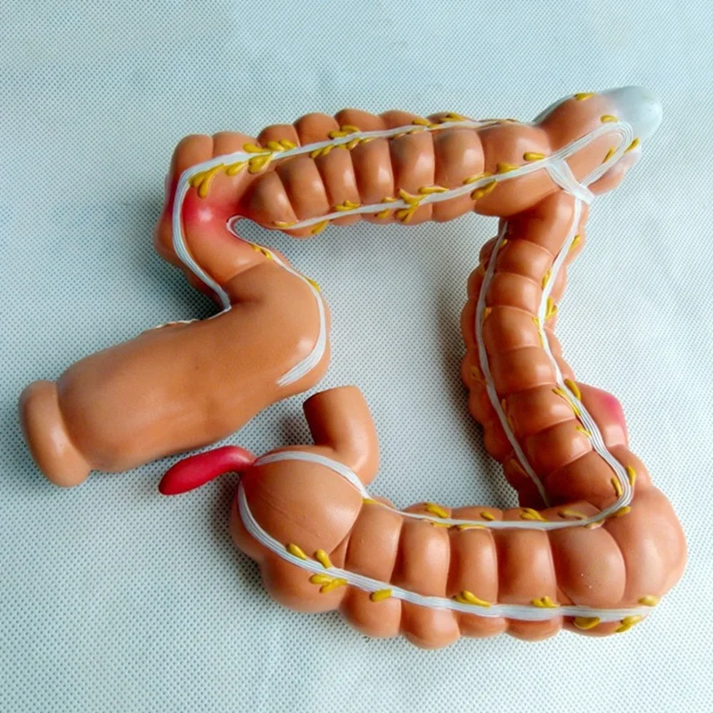 Teaching Model,Human Large Intestine Anatomy Model Visceral Lesion Model Human Digestive System Learning Model