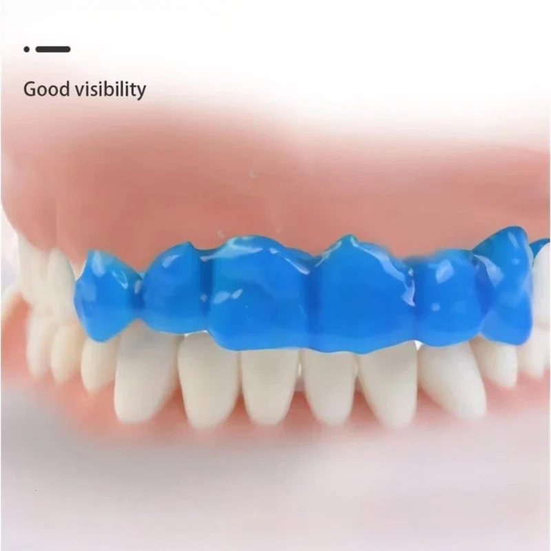 5 قطعة مواد طب الأسنان 37% جل النقش بحمض الفوسفوري 2.5 مللي/5 مللي تبييض الأسنان القشرة حمض النقش وكيل مواد طب الأسنان