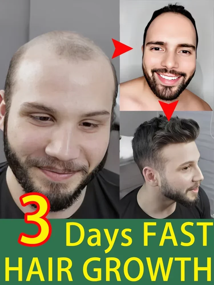 

O óleo de crescimento capilar faz o cabelo crescer rapidamente, repara eficazmente a calvície e a queda de cabelo hereditária
