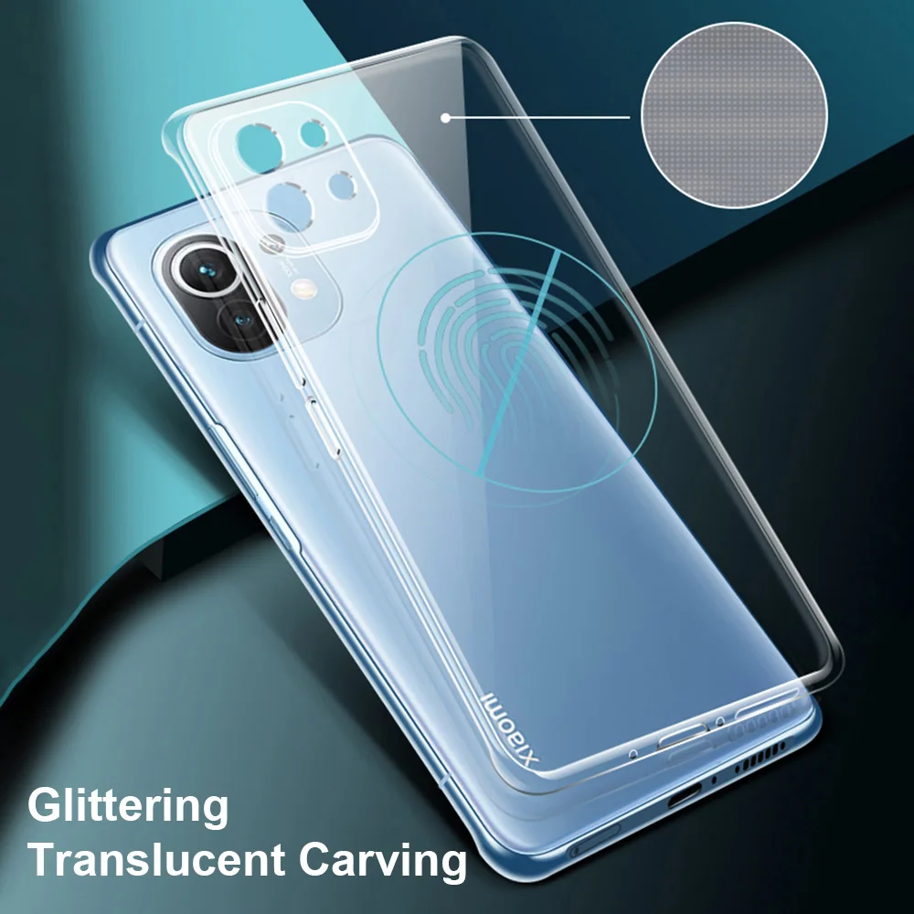 Funda Transparente TPU Xiaomi Mi 11 / 11T / 11i – Antigolpes - imagen 4