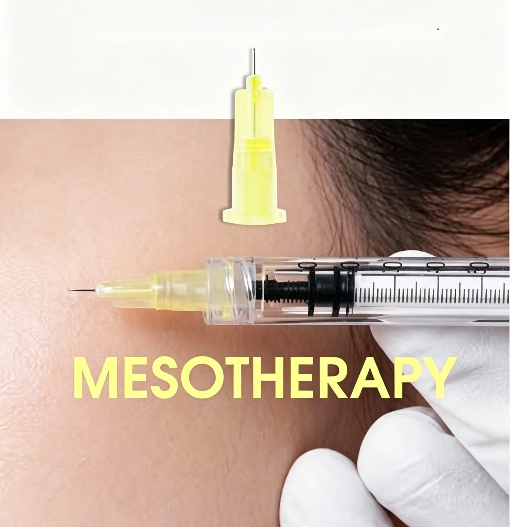 20/50/100pcs Medical Grade Sterile Meso Needle 30G 32G 34G 4mm 13mm Disposable Needle for Mesotherapy Anti-Aging Wrinkle Removal
