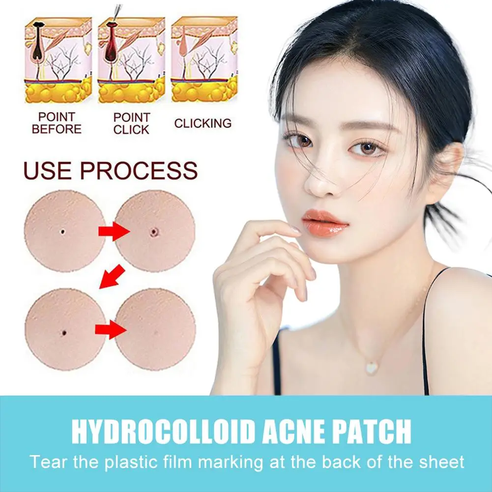 NEW 1 Sheet High-end Pimple Stickers Self Adhesive Disposable Acne Removal Skin Care Stickers Concealer Face Spot Beauty Makeup