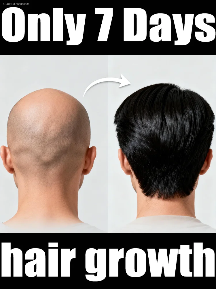 

Спрей для восстановления корней волос восстанавливает поврежденные волосы и придает им объем.