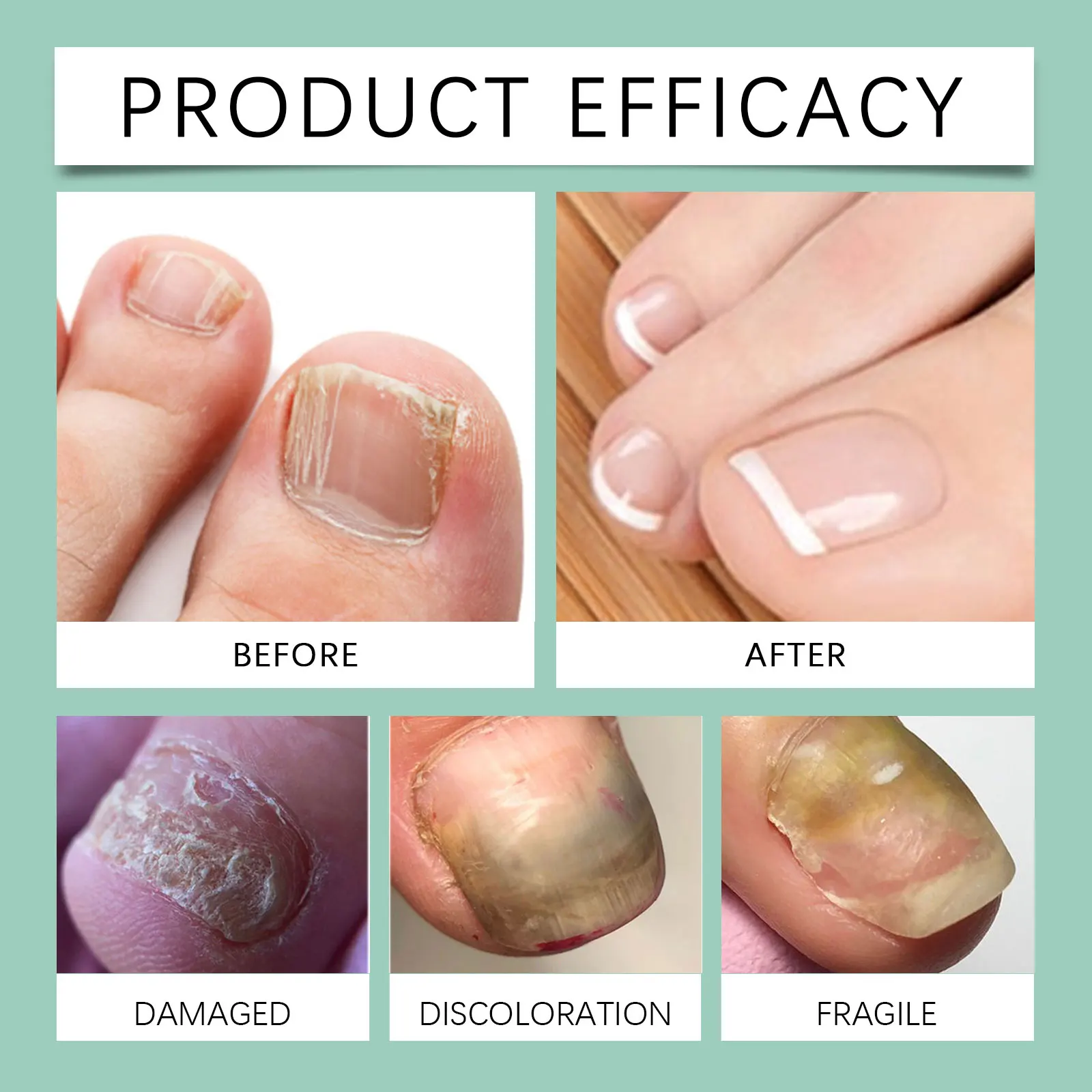 OUHOE Nagelverzorging Pen Set Zacht Voedend Hydrateert Droge Nagelriemen Versterken Zwakke Nagels Snel Absorberend Niet-plakkerig