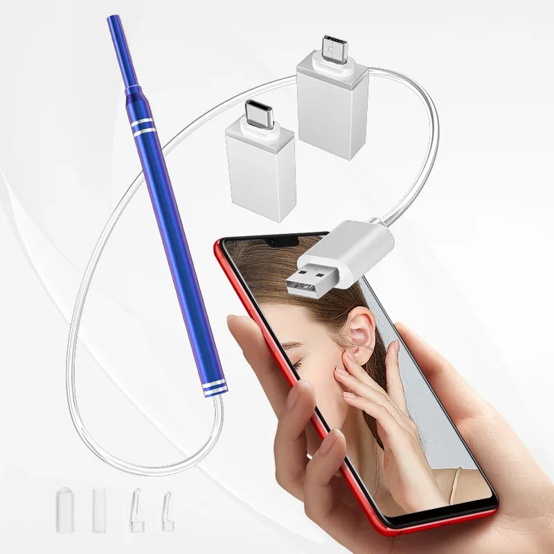 Smart Visual Ear Cleaner 5.5mm 3-in-1 Ear Otoscope Earwax Remover Picker USB C Charging Endoscope MIni Camera Health