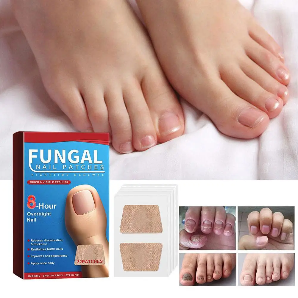 

Foot Nail Repair Patch Grey Fungal Nail Thicken Soft Hand Correction Nail Ingrown Paronychia Toenail Sticker Infection V4S5