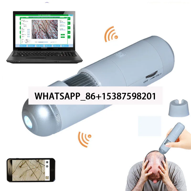 Wireless connection Digital Skin Scalp hair Diagnosis detection Analyzer Machine with Support Andriod iOS Windows