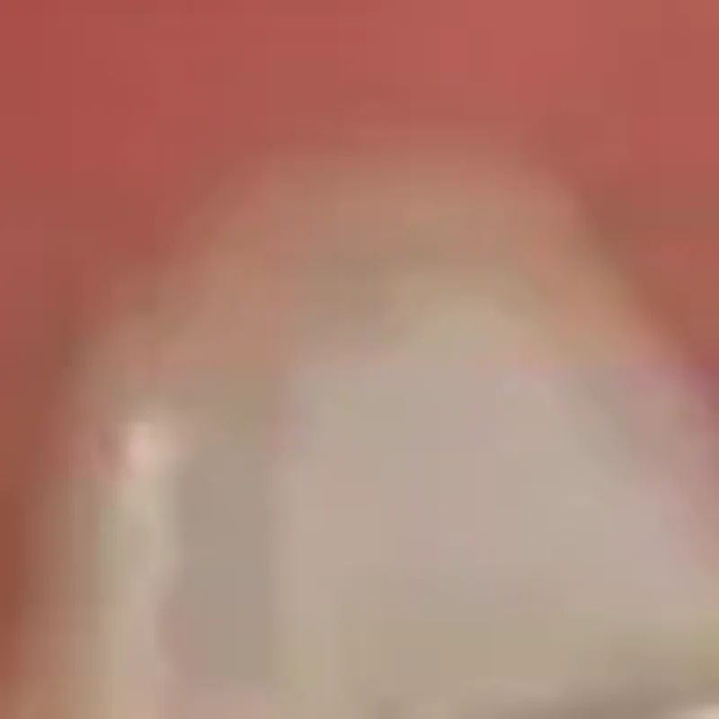 

1 шт., стоматологические ортопедические задние кронштейны, буккальная трубка, склеивающийся держатель для пинцета, шарнирная бумага, пинцет, инструменты, плоскогубцы