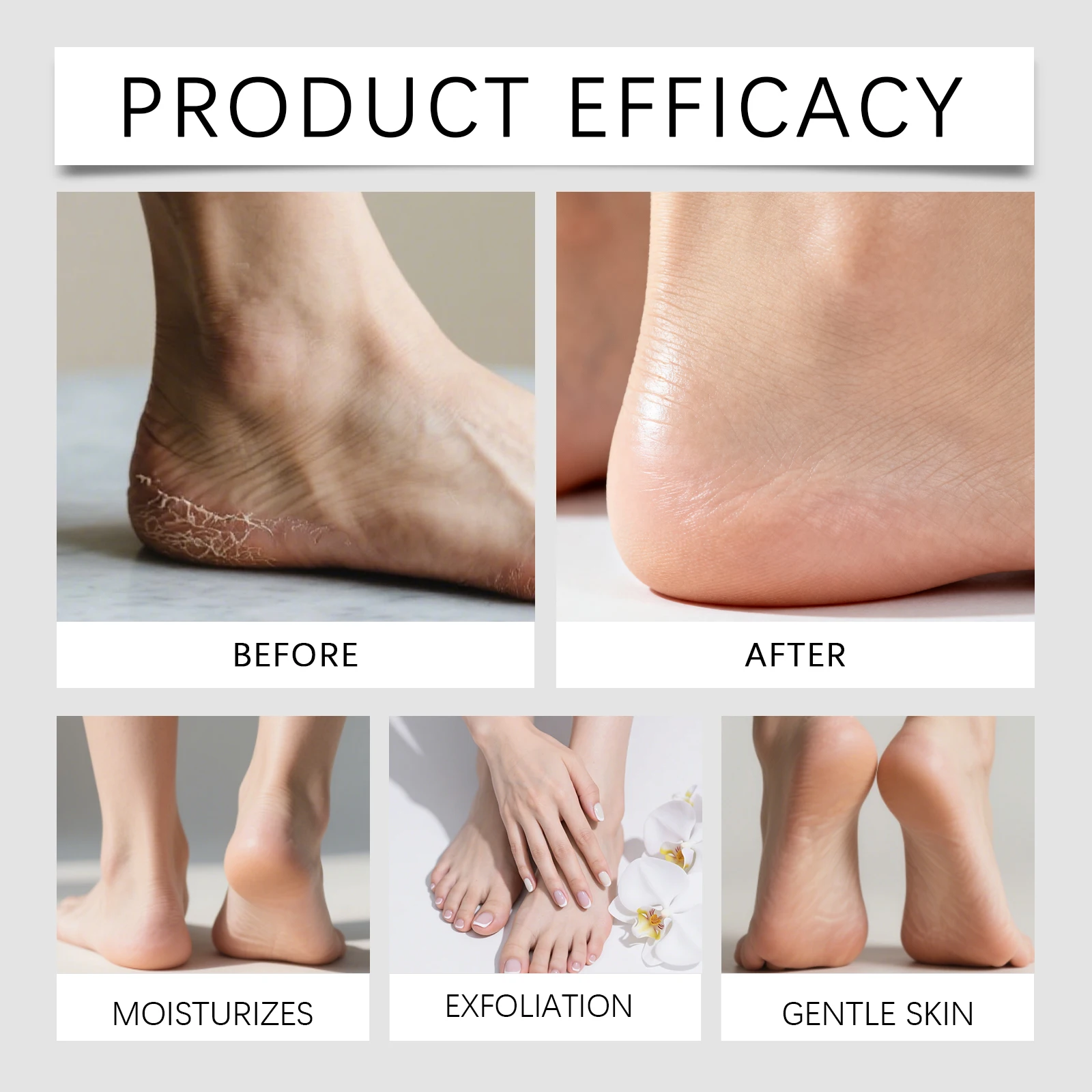 Thumbnail 3 - #12 Top 50 Pumice Stones Worth Buying In 2026