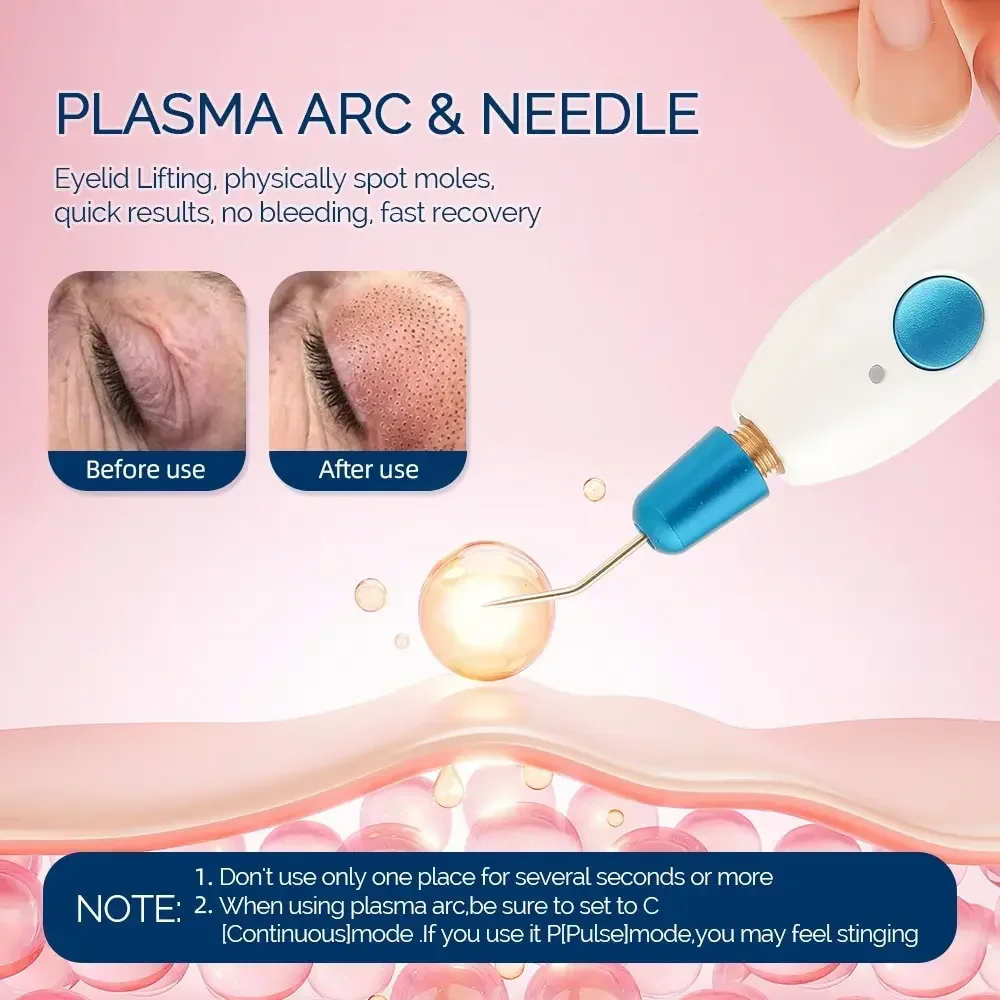 Fibroblast Plamere Neo Plasma Pen for  Removal Skin Lifting Mole Remover Eyelid Acne Treatment Machine Stretch marks removal