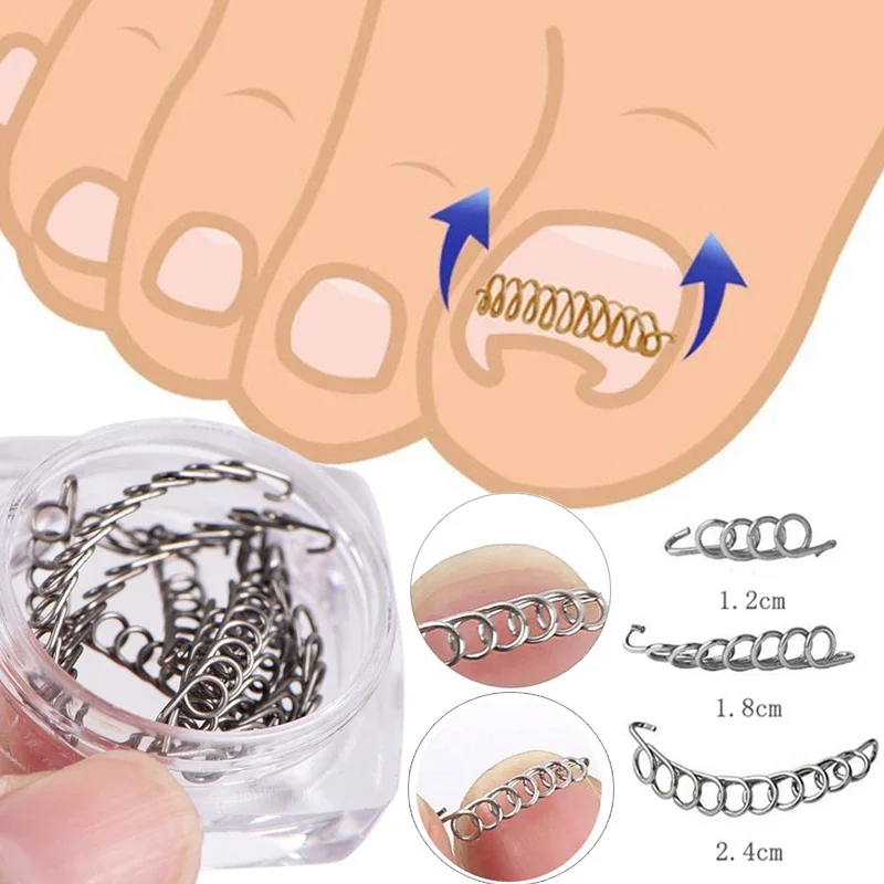 12pcs/box Ingrown Toe Nail Correction Wire Fixer Pedicure Paronychia Recover Toenails Corrector Foot Care Tool Straightening