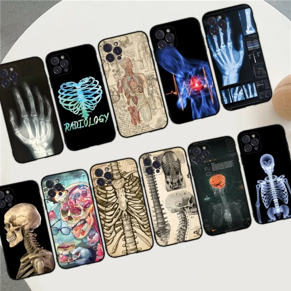 Radiological Human Organs Skeleton Phone Case For IPhone 15 14 13 12 Mini 11 Pro XS Max X XR SE 6 7 8 Plus Soft Silicone Cover