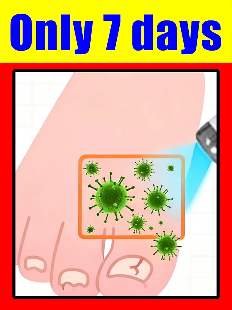 

Лазерная ручка 2-го поколения Необходимое устройство для лазерной терапии синего света для семьи