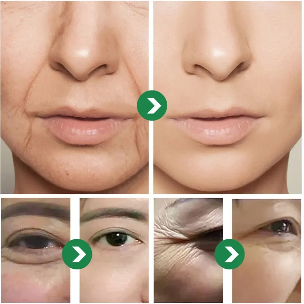 Anti-wrinkle Cream Japanese Six Peptides Moisturizing Anti-early Aging For Sensitive Skin Face And Neck Repair Products 50g
