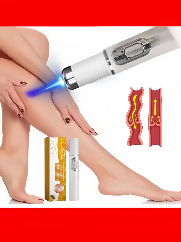 

Лазерная терапия вен синего света | Домашнее лечение паукообразных вен и отеков | Сейф для кожи куперозы