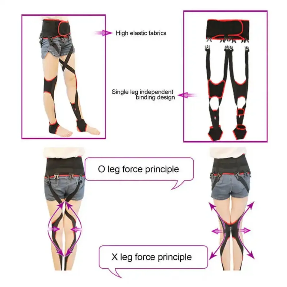 Polymer Fibers O/X Leg Type Correction Belt Leg Posture Corrector Band Bandage High Elasticity Leg Knee Adjust Posture Corrector