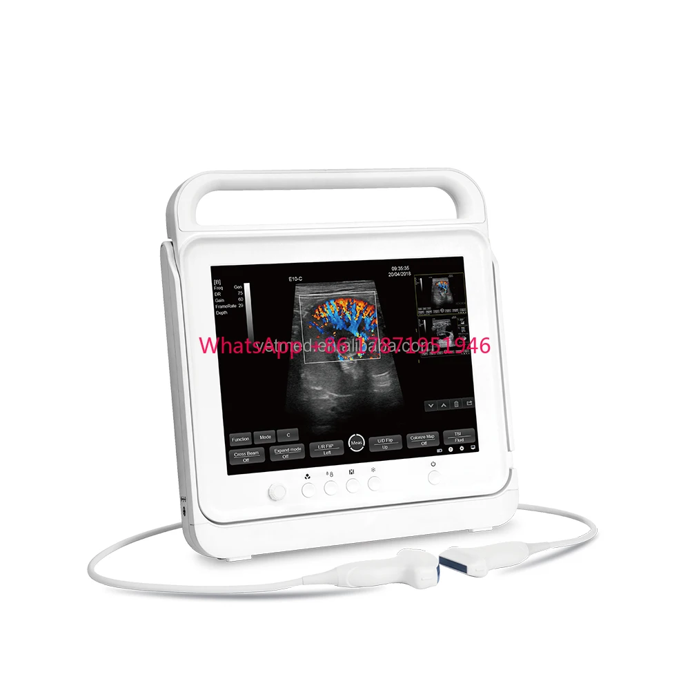 

Quality Animal Use Portable Touch Color Doppler Ultrasound Scanner Imaging Device