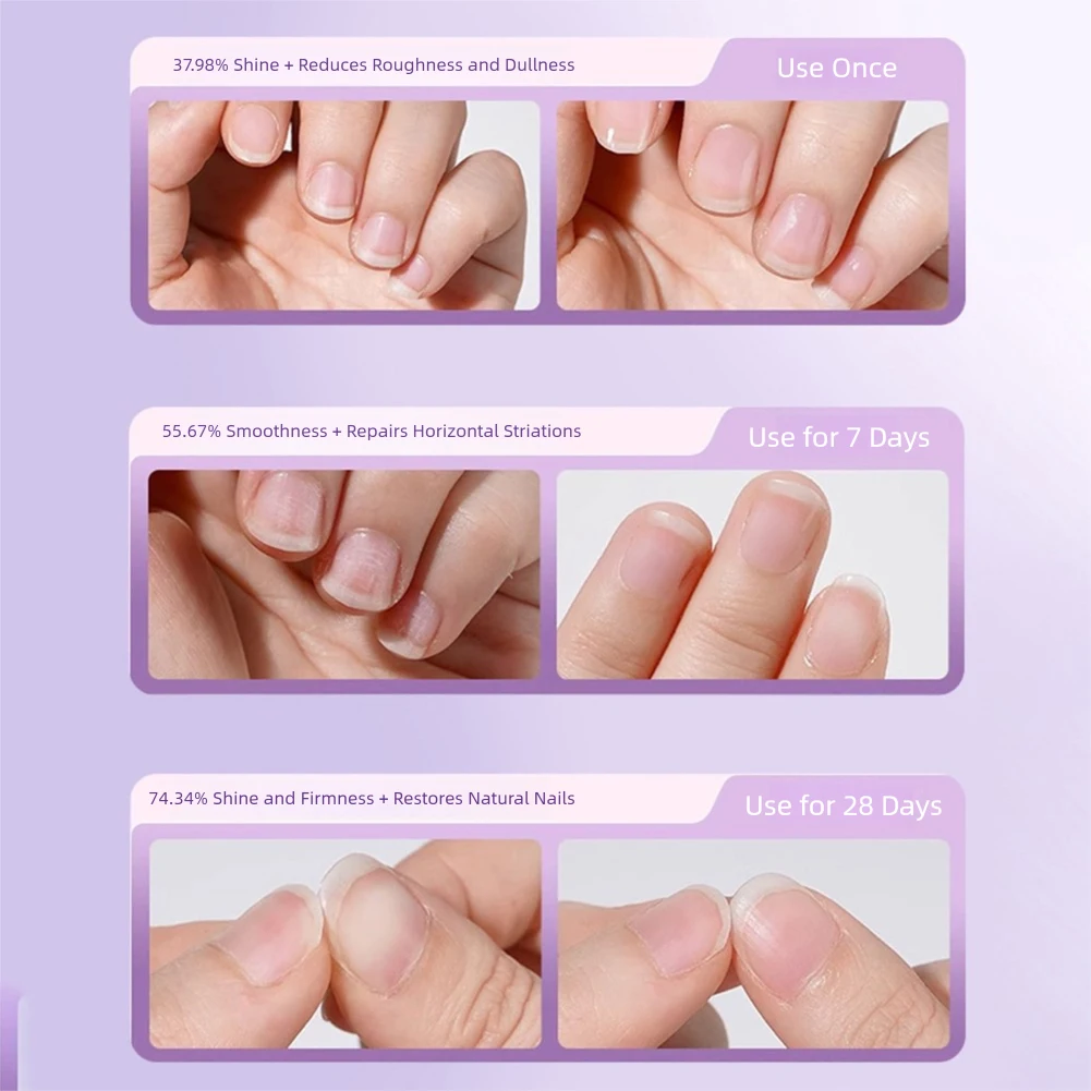 세라믹 큐티클 오일 푸셔 펜, 손톱살 치료, 손톱살, 건조하고 손상된 손톱, 네일 아트용 큐티클 제거 펜 (1/2/3개입)