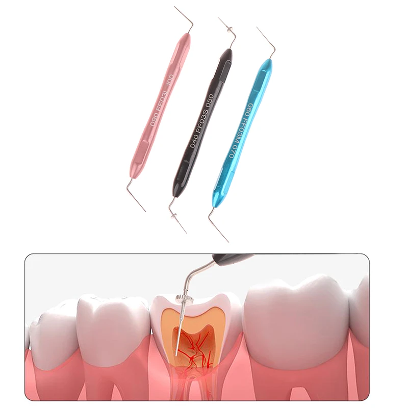 Appareil de remplissage dentaire Gutta Percha, prise manuelle endodontique, dispositif de pression verticale, remplissage dentaire, remplissage de canal radiculaire Chev