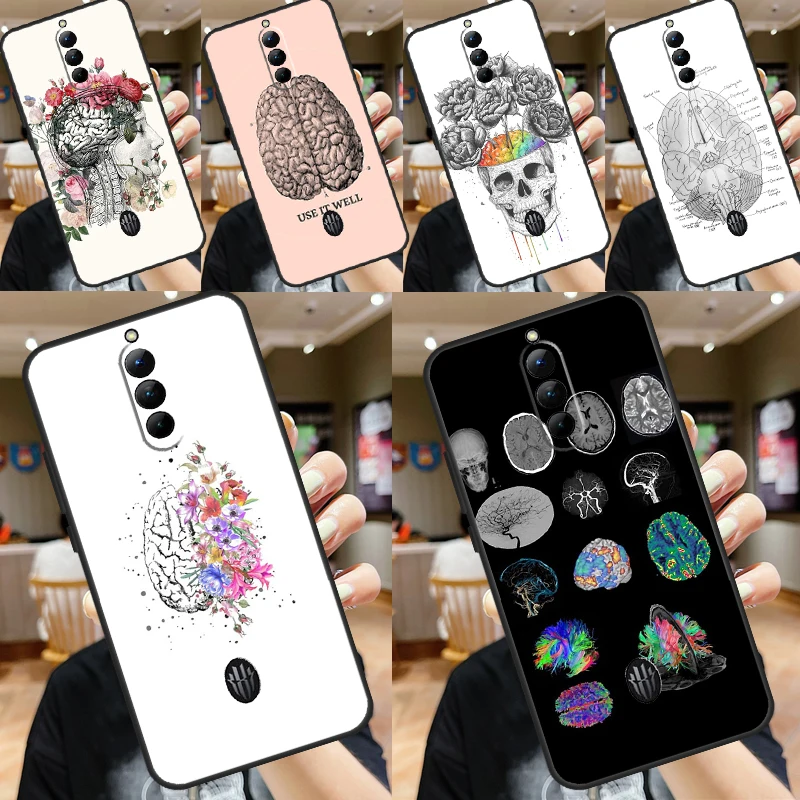 Anatomy Brain Case For ZTE Nubia Red Magic 8S 8 9 Pro Plus RedMagic 6 6S Pro 7 7S Pro 6R 5S 5G Soft Cover