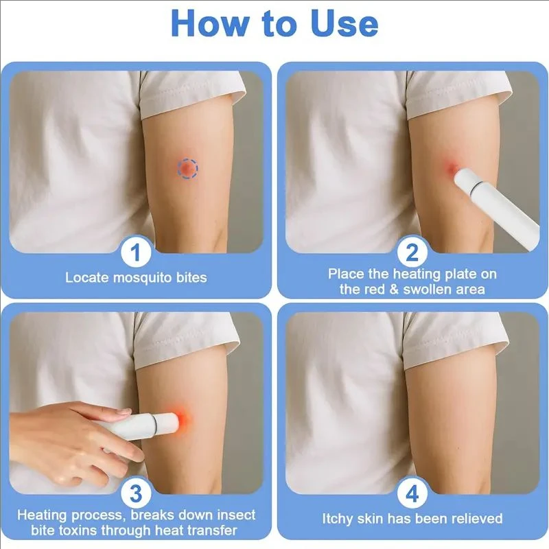 جهاز تخفيف الحكة الكهربائي المحمول القابل لإعادة الشحن - تخفيف سريع لدغات البعوض، أداة صيفية أساسية مضادة للبعوض، البعوض