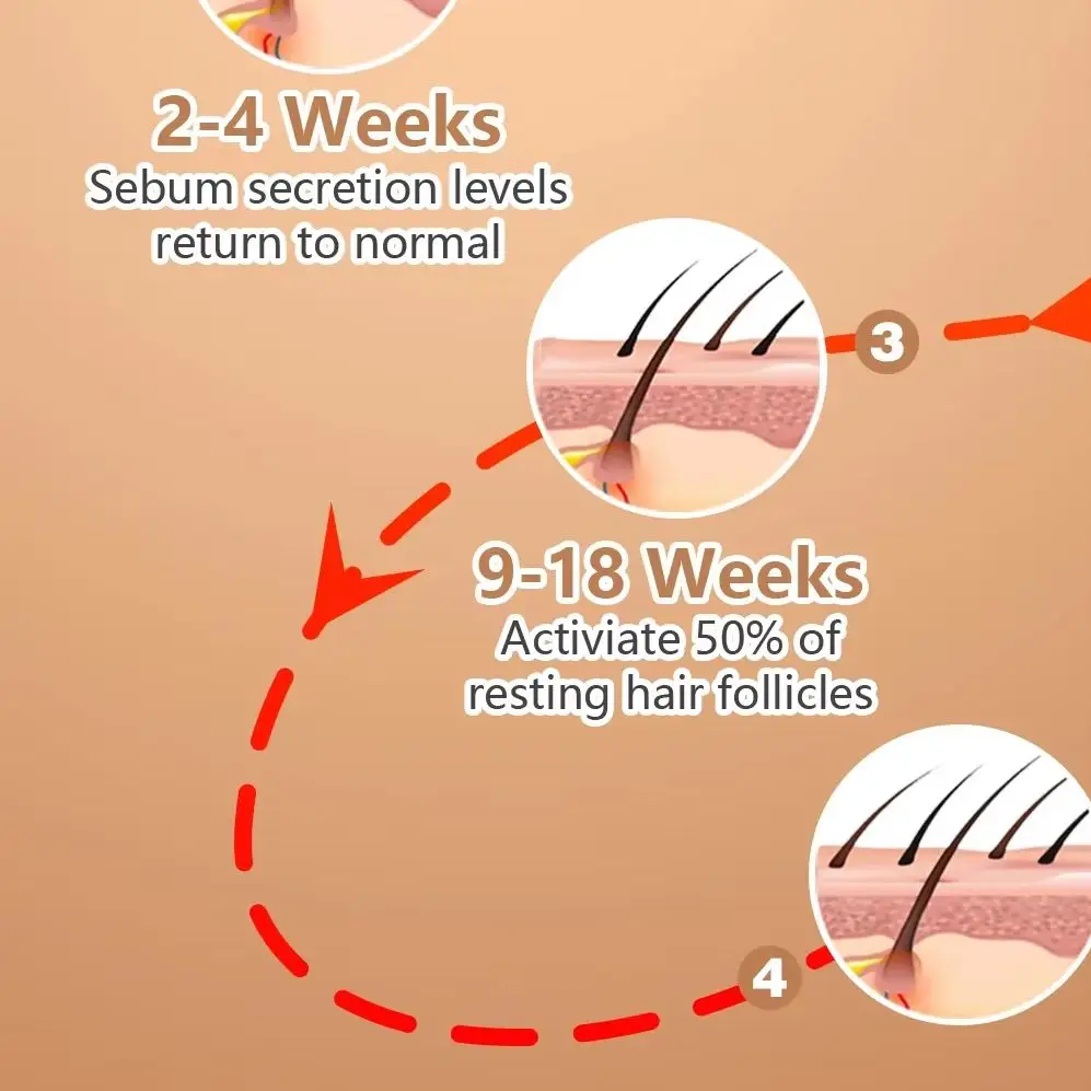

Усовершенствованная лазерная шапка с 96 диодами для восстановления роста волос, предотвращения и лечения выпадения волос, полное покрытие кожи головы