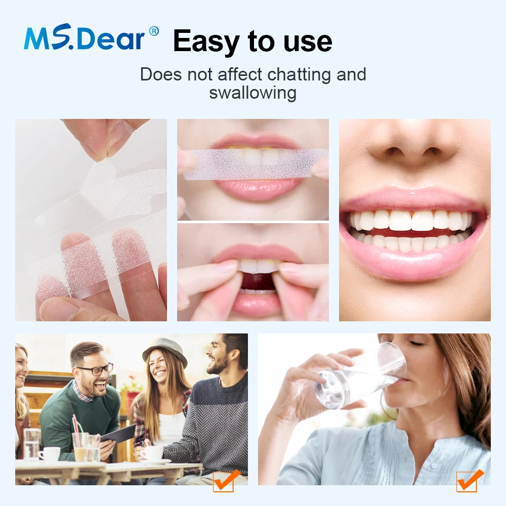 9D Teeth Whitening Stickers Mi - đánh giá và giá Teeth Whitening Gel Refills