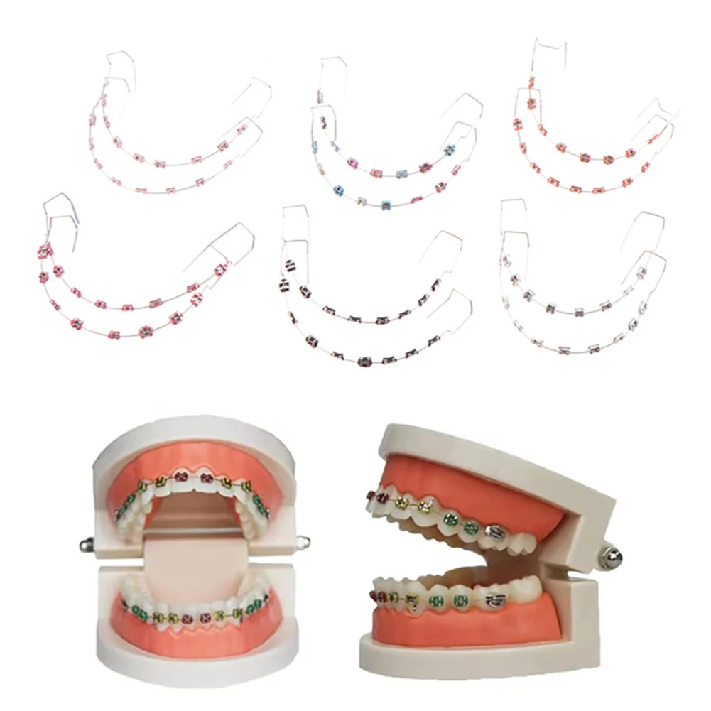 Colorful Dental Fake Braces: My Real Experience with Temporary Tooth Decoration for Style and Fun