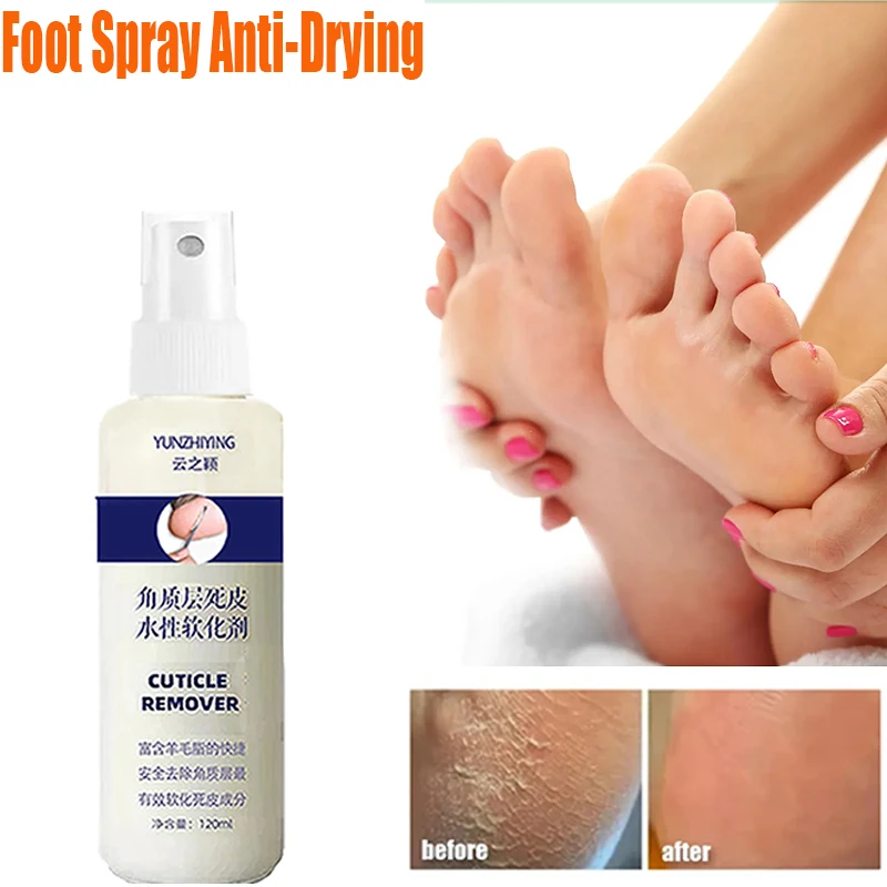 120mlCalluses Remover Foot Spray Anti-Drying Exfoliating Heel Cracked Repair Pedicure Hand Elbow Eliminate Dead Skin Foot Liquid