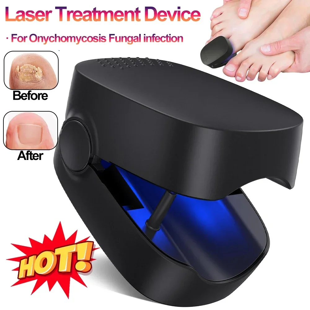 Nail Fungus Treatment LED Laser Device for Cleaning Onychomycosis USB Charge 905nm Infrared Light 470nm Blue Light Nail Salon