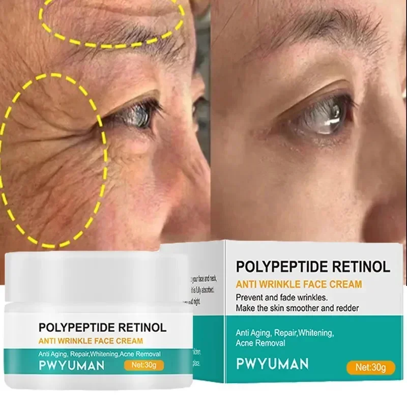 

Средство для удаления морщин и ретинола, антивозрастной крем для лица, подтягивающий, укрепляющий, Восстанавливающий и восстанавливающий кожу