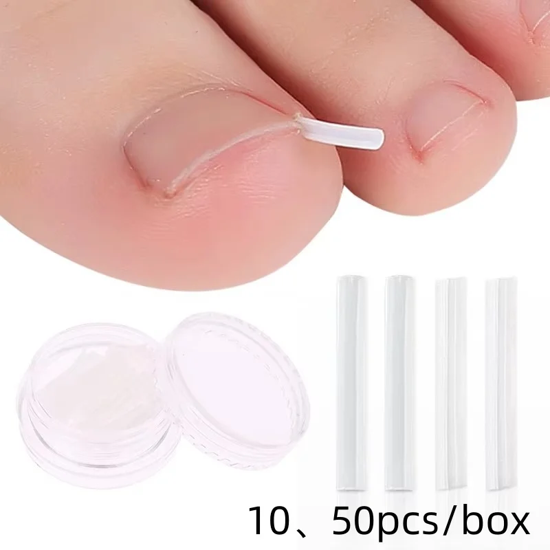 50Pcs Ingrown Toenail Correction Tool Ingrown Toe Nail Treatment Elastic Patch Sticker Straightening Clip Brace Pedicure Tool