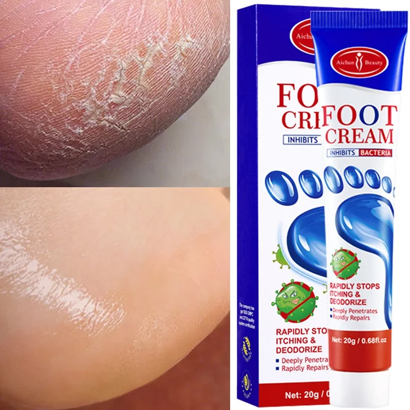 Foot Fungus Removal Cream Relieve Foot Itching Remove Beriberi Dead Skin Foot Sweat Moisturize Repair Foot Cracked Ointment