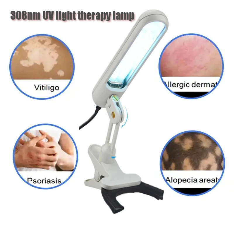 

311nm Uv Light Therapy Lamp Narrow-Band Uvb For Scalp Psoriasis Vitiligo Patients Using Large Area Irradiation