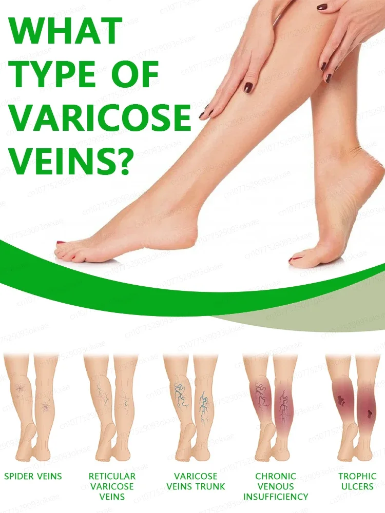 Gel to relieve varicose veins, relieve lumps in legs