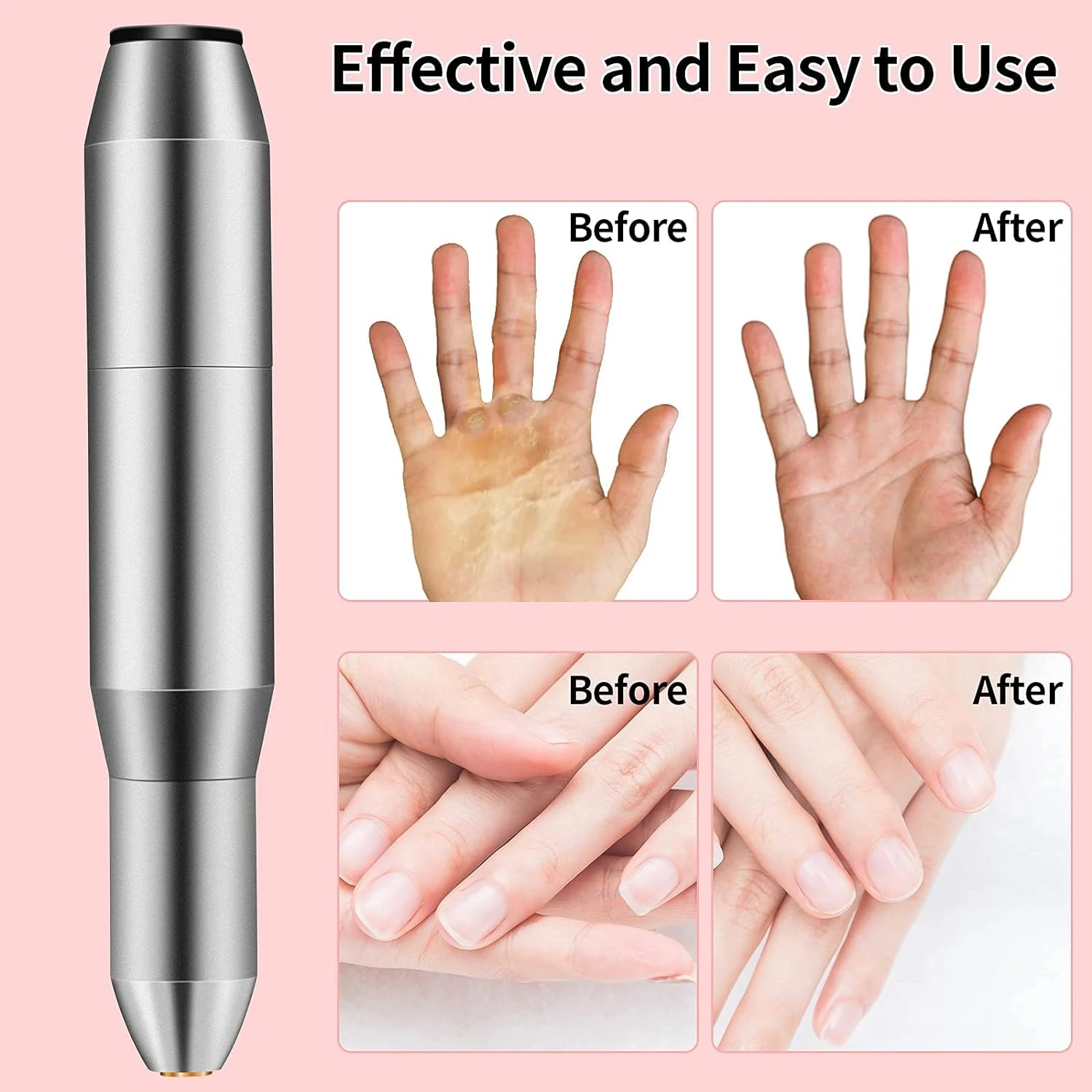 Conjunto de broca de unha profissional portátil e conveniente para manicure e pedicure perfeitas - obtém sem esforço em beltifu