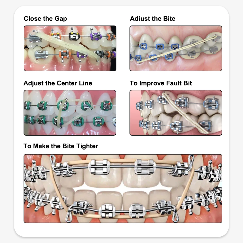 ELIJAH CYZ115 5000pcs/Box O-ring/inter Oral Elastics Dental Orthodontic Zoo Pack Elastics Rubber Bands Latex Ligatures Ties