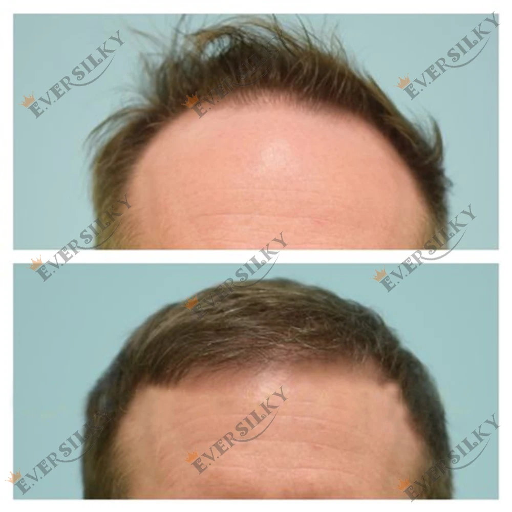 

Самый светлый блонд 22r # Ультратонкая накладка для волос 0,02 мм с естественной линией роста волос, 80% невидимая, серая # Мужской парик-накладка 550 из 100% натуральных человеческих волос (капиллярный протез)