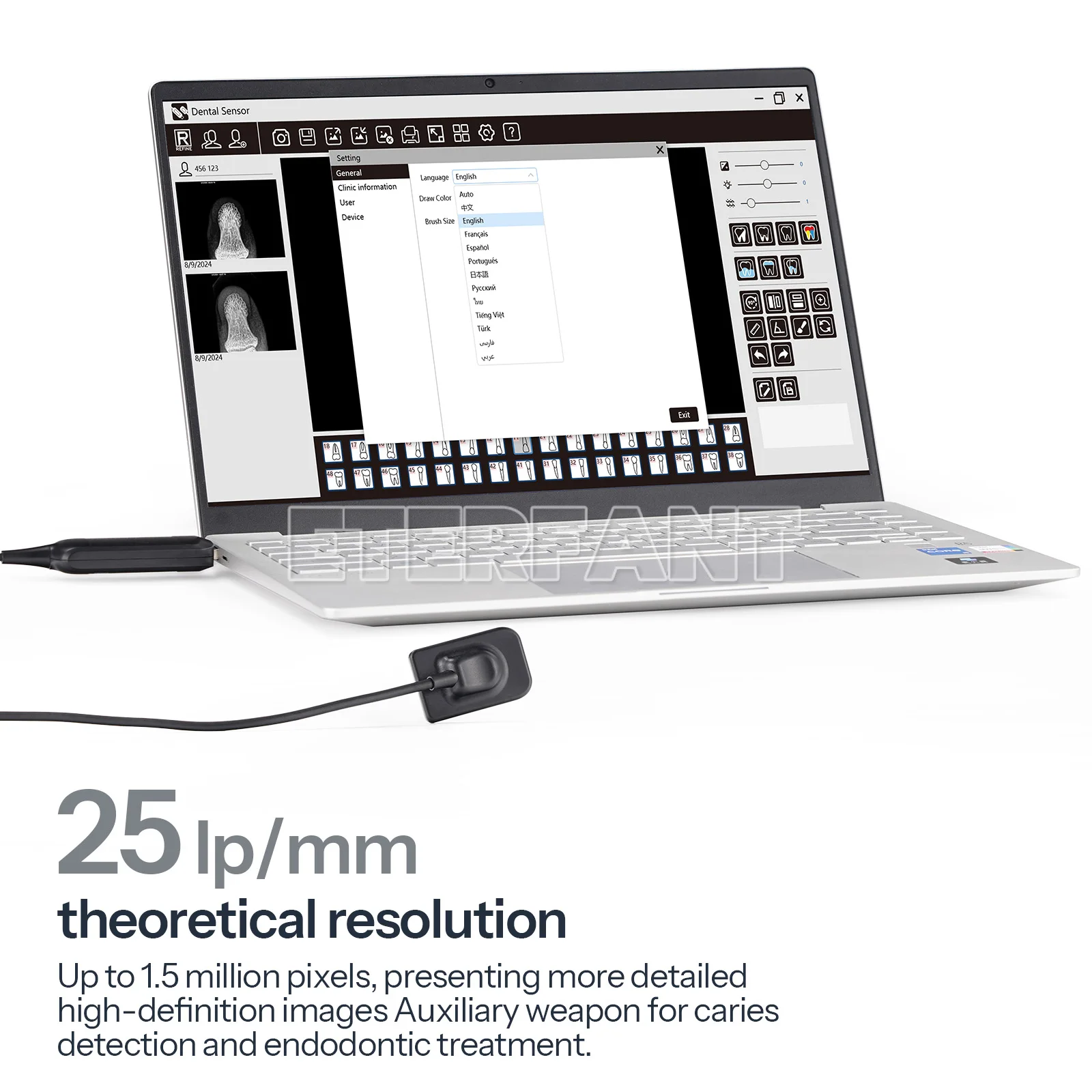 ENTERFANT Dimensioni 1/2 Sistema di immagini a raggi X dentali Sensore a raggi X digitale RVG intraorale Imaging super chiaro Comfort ultrasottile