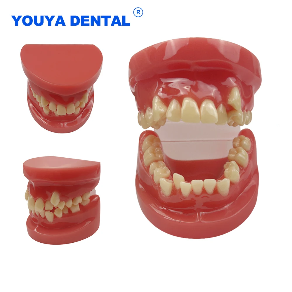 

Dental Teaching Model with With Braces Full Metal Brackets For Studying Typodont Orthodontic Models Dentistry Teaching Demo