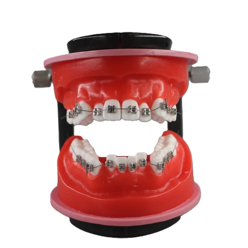 

YTYIN Orthodontic Correction Model Typodont Display Model With Bracket