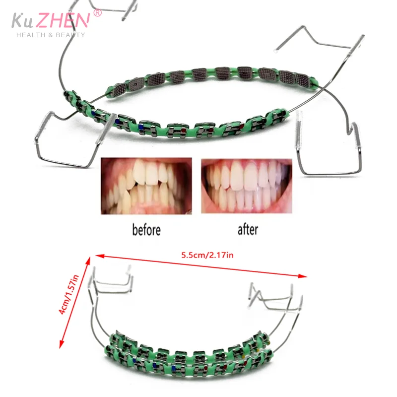 

1Pair New Colorful Brackets Dental Fake Braces Temporary Tooth Decoration With Metal Wires Bracket Ligature Tie Dental Tool