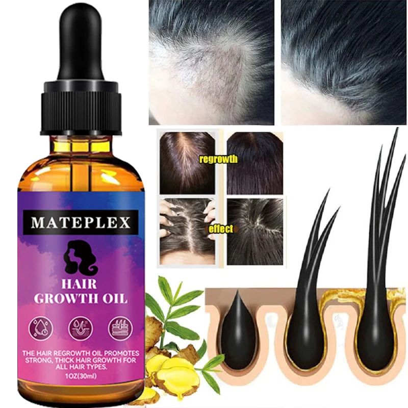 30Ml Serum Pertumbuhan Rambut Minyak Esensial Anti Rambut Rontok Cepat Tumbuh Minyak Pertumbuhan Rambut Perawatan Minyak Esensial Perawatan Kesehatan Kecantikan Jahe