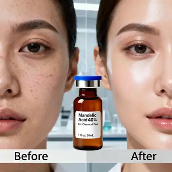 Kyselina mandlová 40% Peeling na obličej 18% 30% 10% - Chemická exfoliace Profesionální kosmetická kvalita 30ml Jemný exfoliační roztok s AHA 10 nejlepší prodej chemický peeling - №3