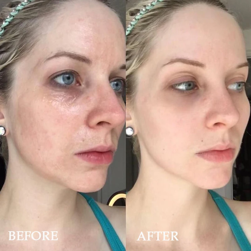 Korea DIY Wunder Gesichts maske Peptid Hyaluron säure Essenz Kit Reparatur Facelift ing Straffung Aufhellung feine Linien Hautpflege