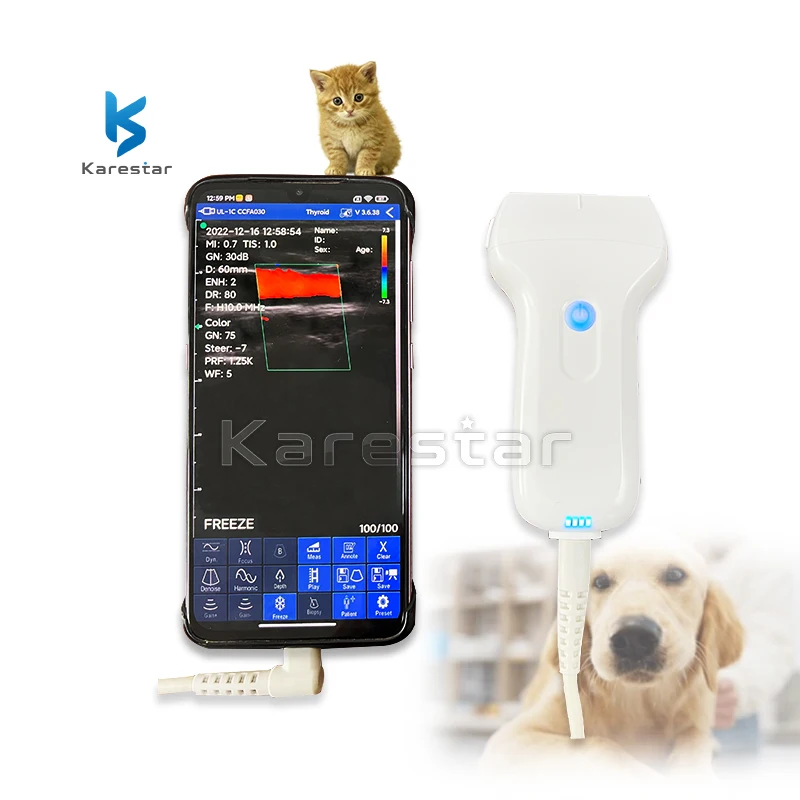 New Arrival USB Ultrasound Medical Wireless Probe Pocket Wifi Vet Wireless Ultrasound Probe